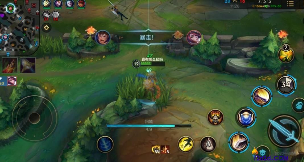 英雄联盟手游盖伦最强出装是什么