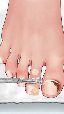 沉浸式修脚大师游戏下载